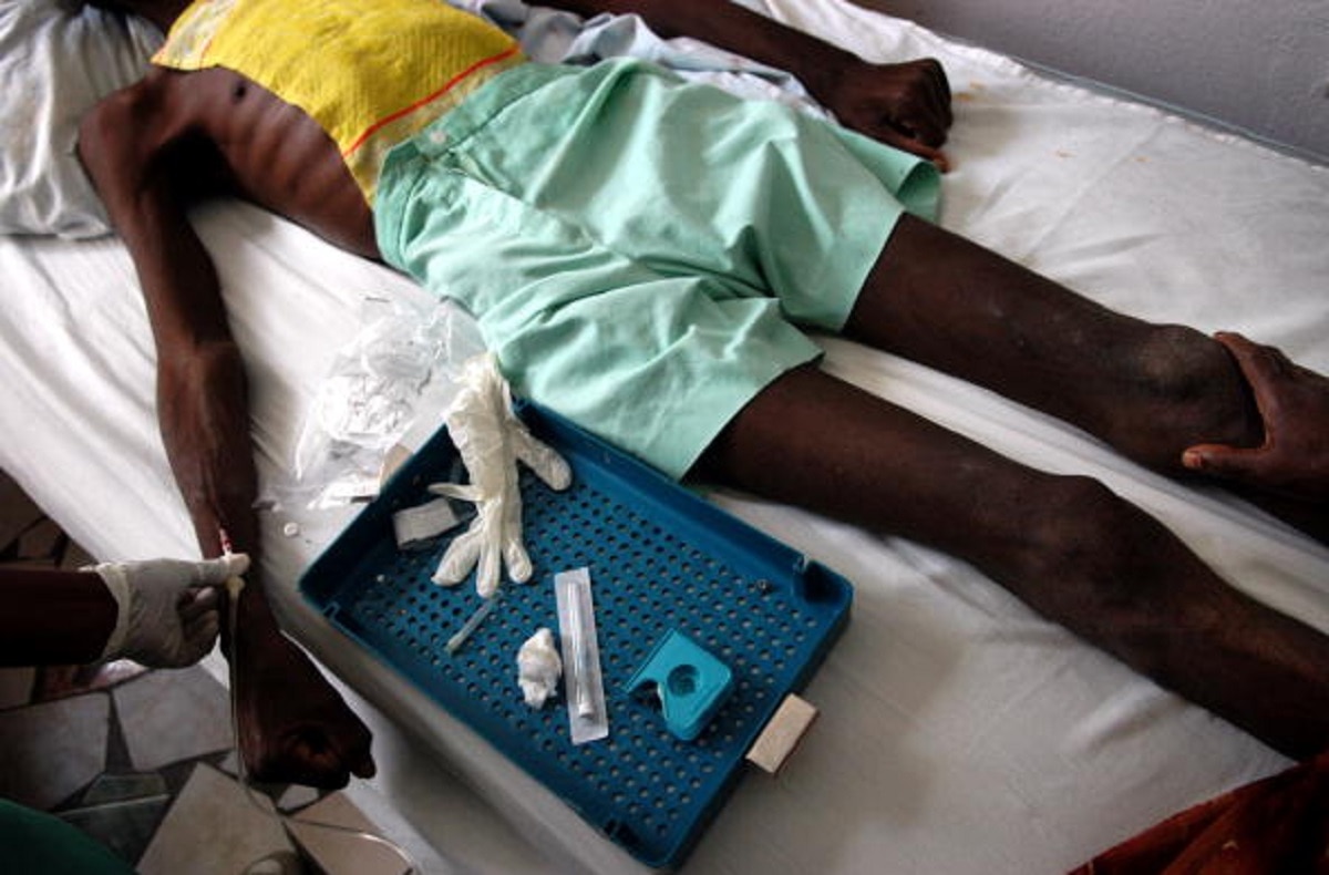  इम्यून का खराब रिएक्शन