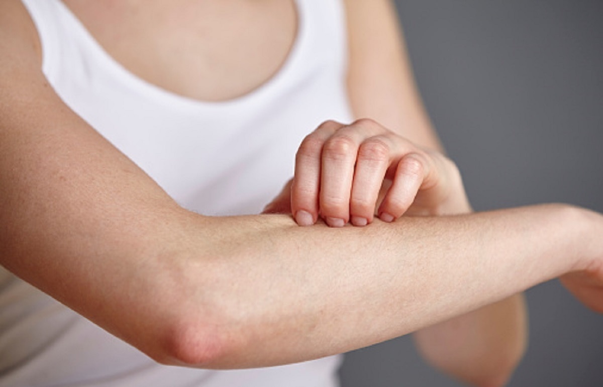 स्किन से जुड़ी समस्याएं