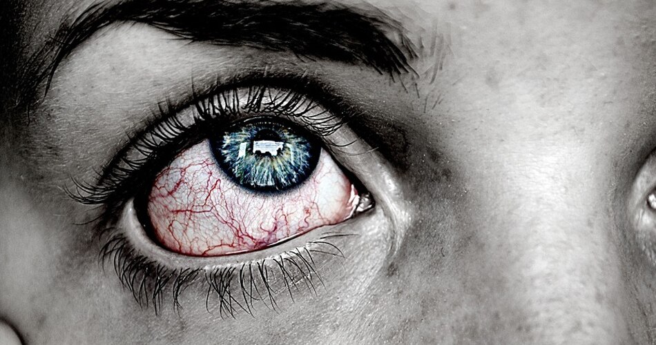 आंखों का सूखना