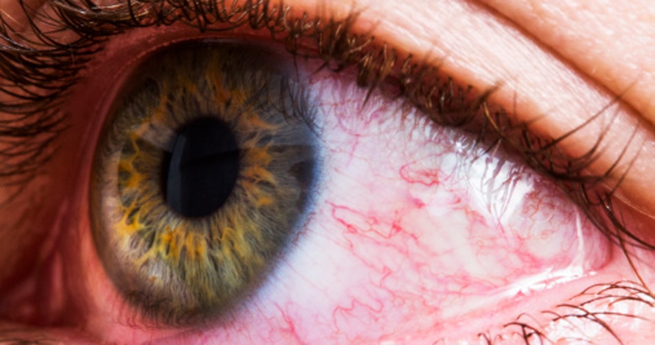 गुलाबी आंखें