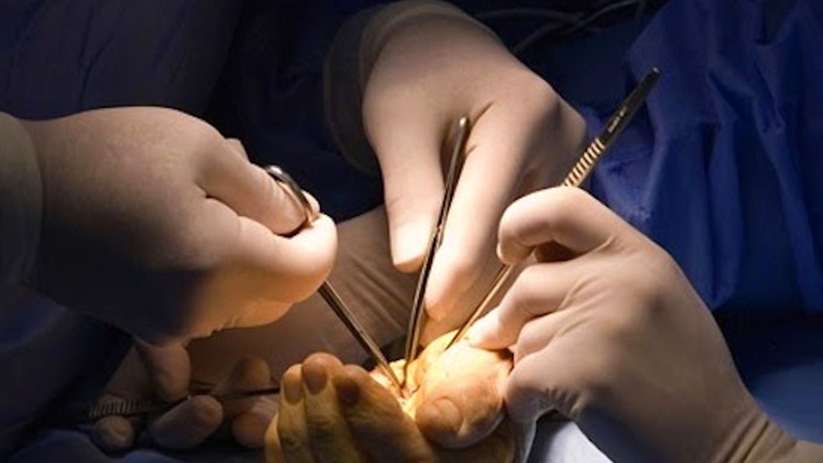 जोधपुर में युवक का हाथ लिफ्ट में आने से कटा, डॉक्टरों की टीम ने सर्जरी कर जोड़ा