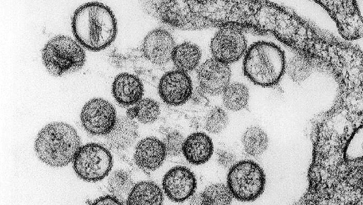 आंध्र प्रदेश में फैली अज्ञात बीमारी