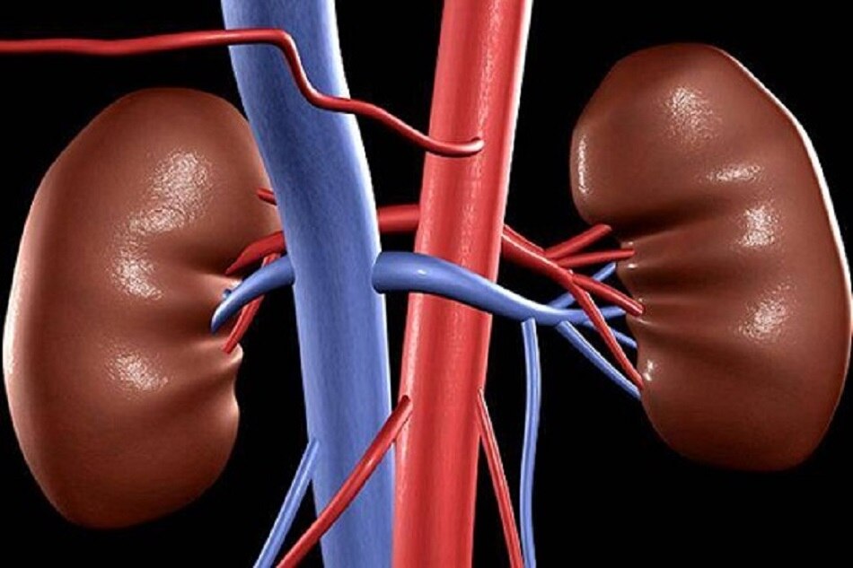 किडनी की समस्या
