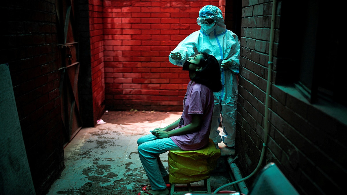 Mucormycosis is dangerous for diabetic corona patients