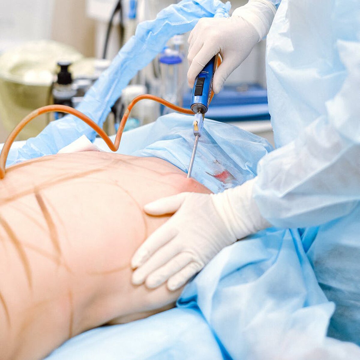 प्रतीकात्मक तस्वीर