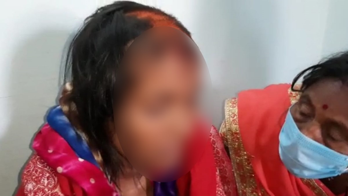 नई नवेली दुल्हन के काटे बाल और फेविक्विक से चिपका दी आंख (फोटो आजतक)