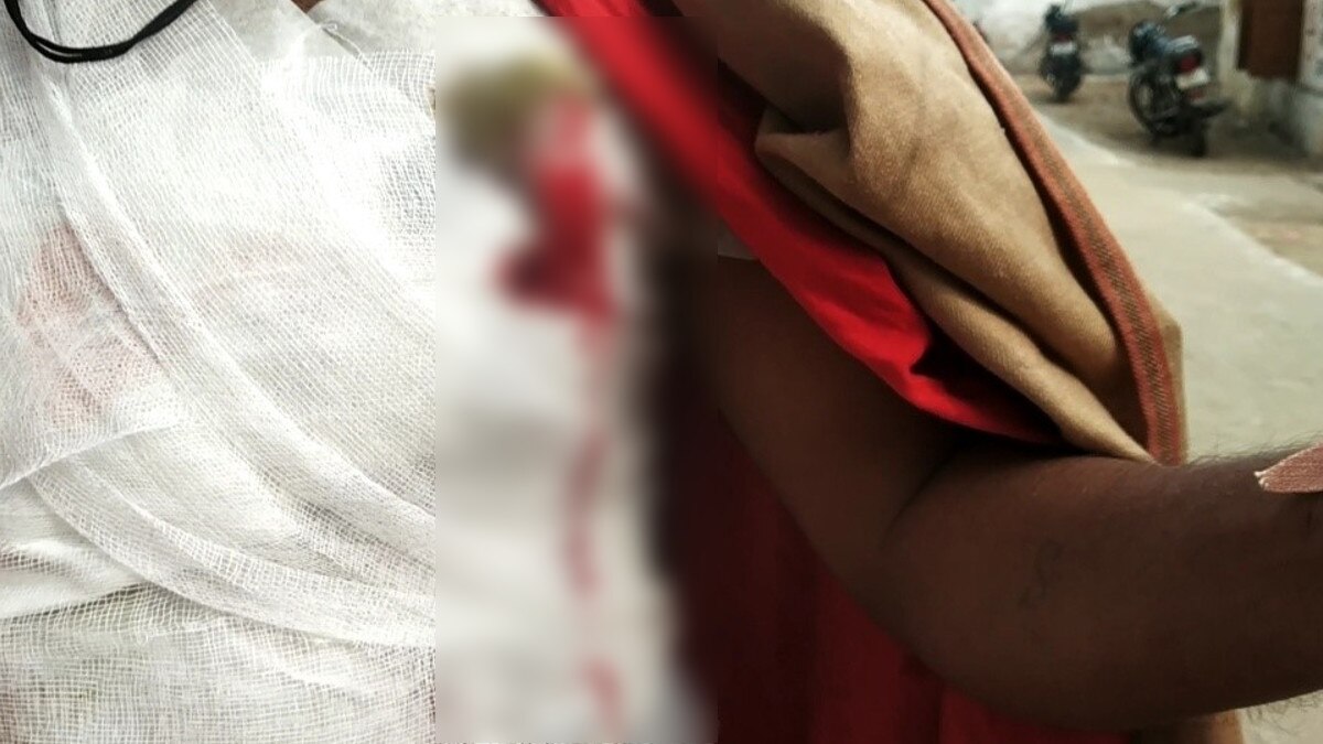 चाकूबाजी में खून से लथपथ को नहीं मिला स्ट्रेचर,अस्पताल का चक्कर लगाता रहा मरीज