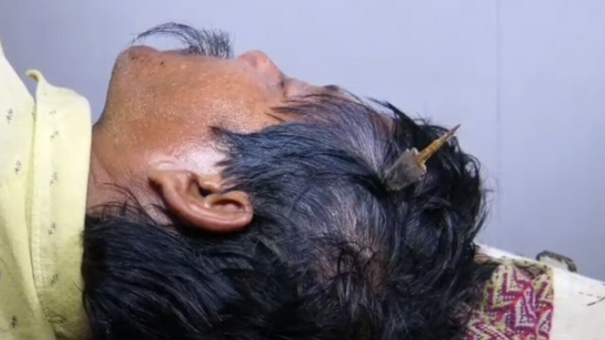 पुलिस ने मामला दर्ज कर लिया है और आरोपियों की तलाश शुरू की.