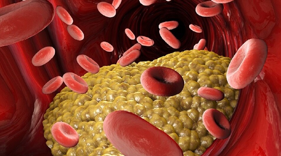 डायबिटीज 6