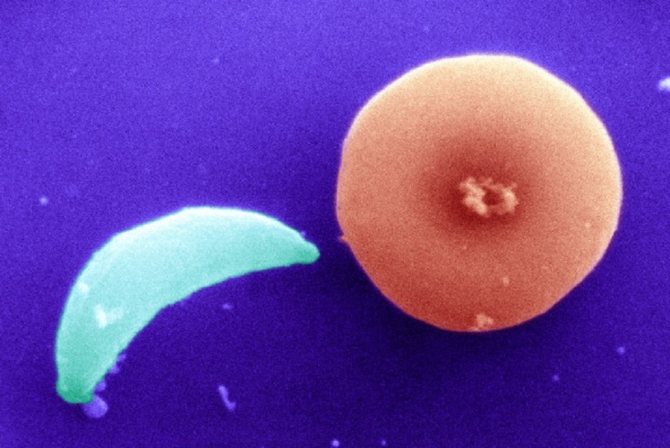 अभी और शोध की जरूरत