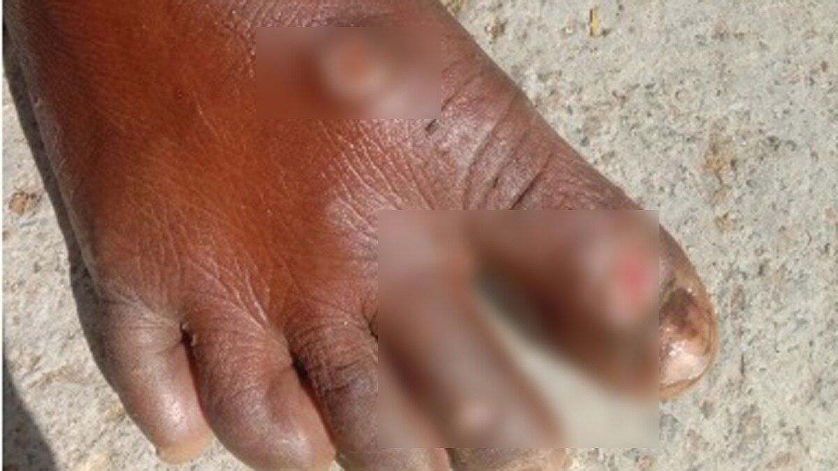 घर का काम न करने पर 7 साल की मासूम के नाखून उखाड़े और दागते थे सरिया.