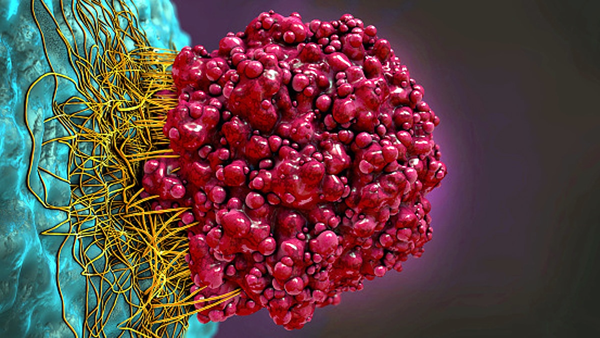 Coronavirus may hide in patients brain