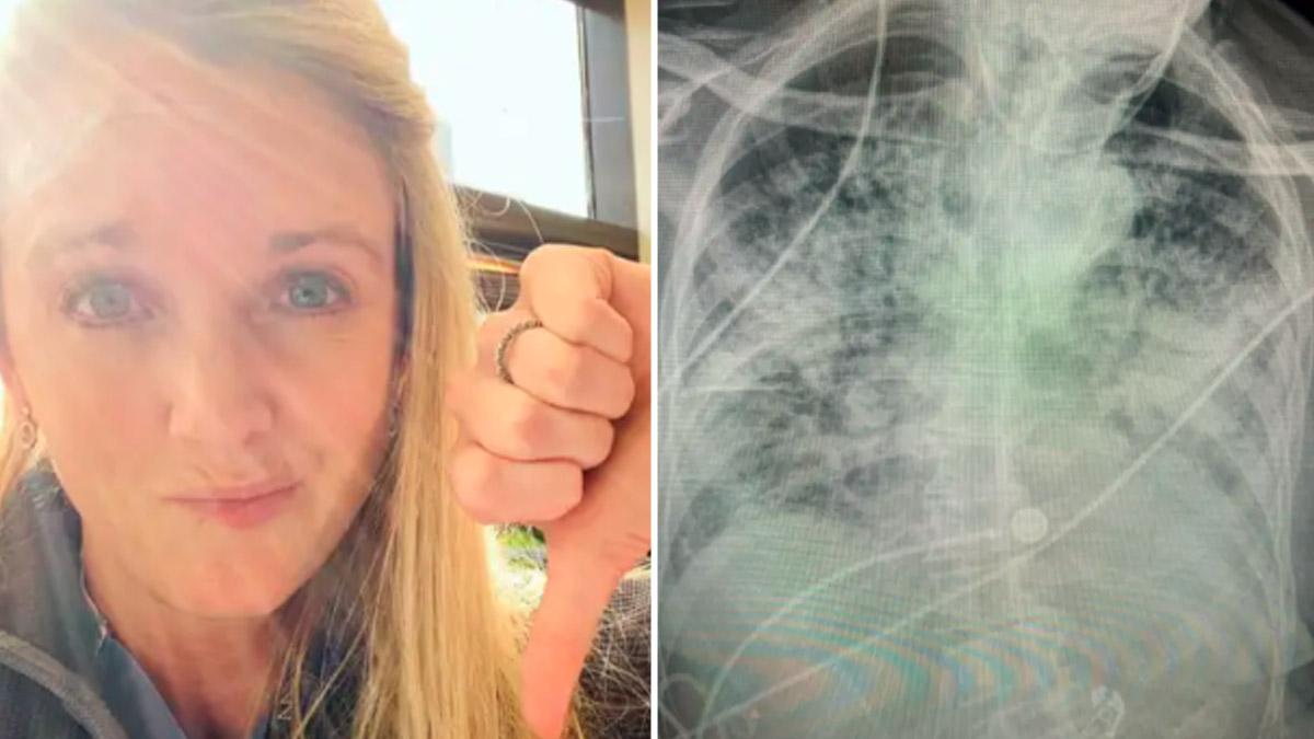 डॉक्टर ब्रिटनी और कोरोना मरीज का एक्स-रे