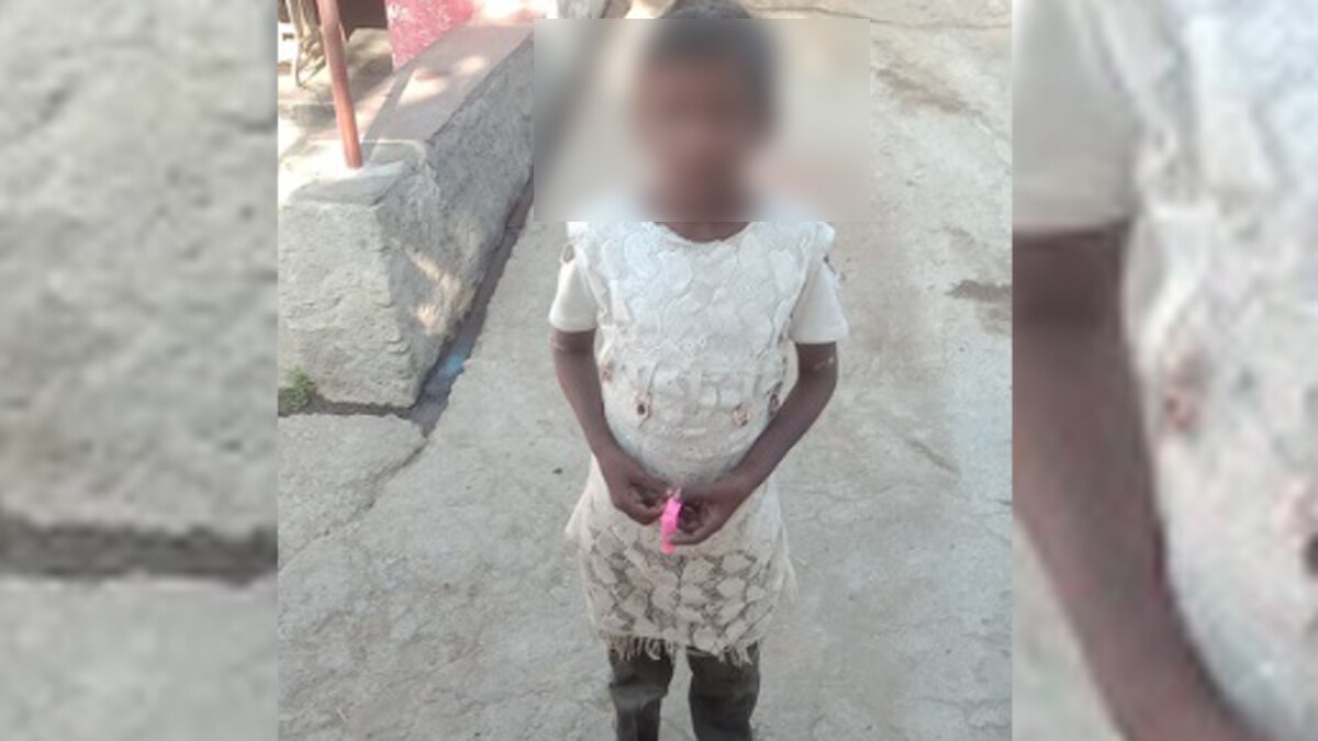 अपने ही बने दुश्मन, बच्ची बंधक बनाकर रखा और सिगरेट से दागा