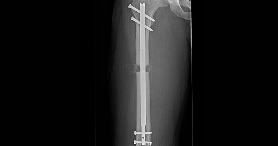 कॉस्मेटिक सर्जरी 5