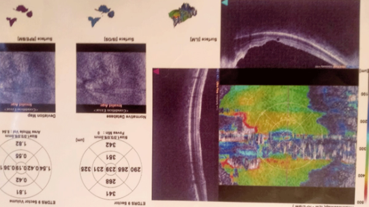 (फोटो आजतक)