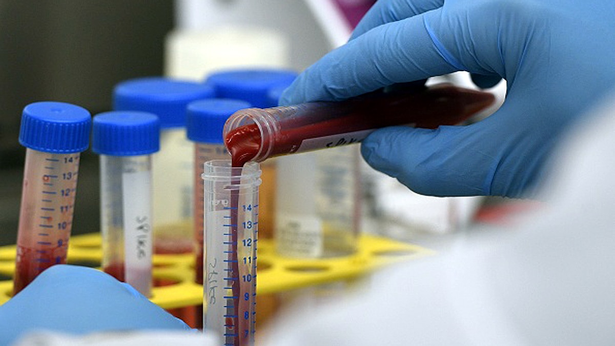 How the First Corona Vaccine Made