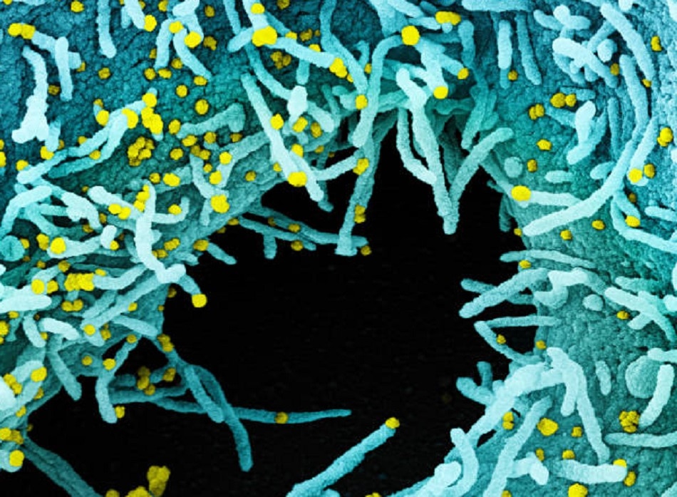 डिसीज एक्स