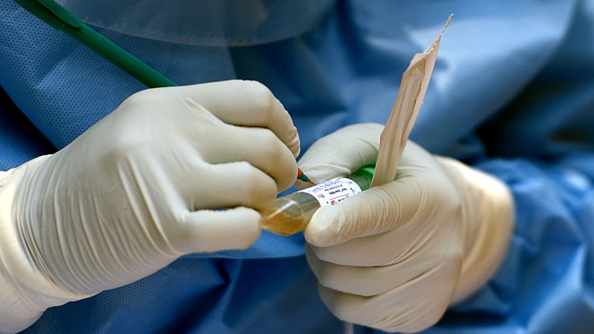 Mumbai Corona Strain E484K Mutation