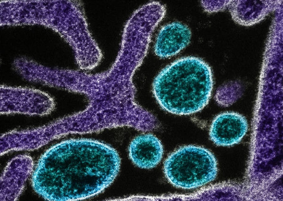 लासा फीवर