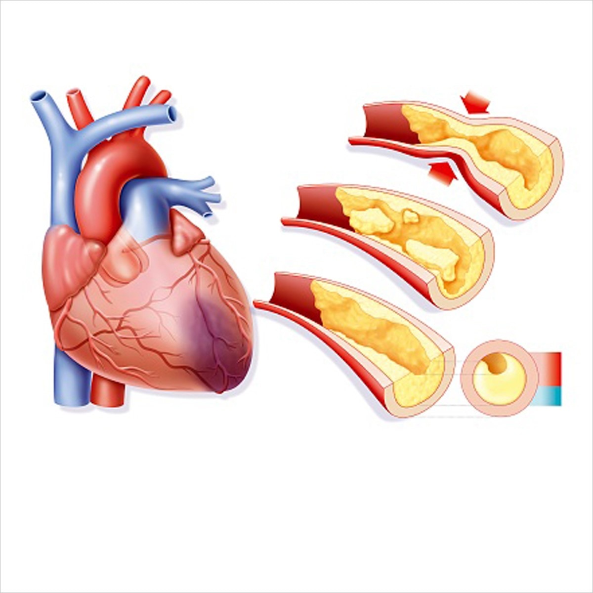 प्रतीकात्‍मक फोटो
