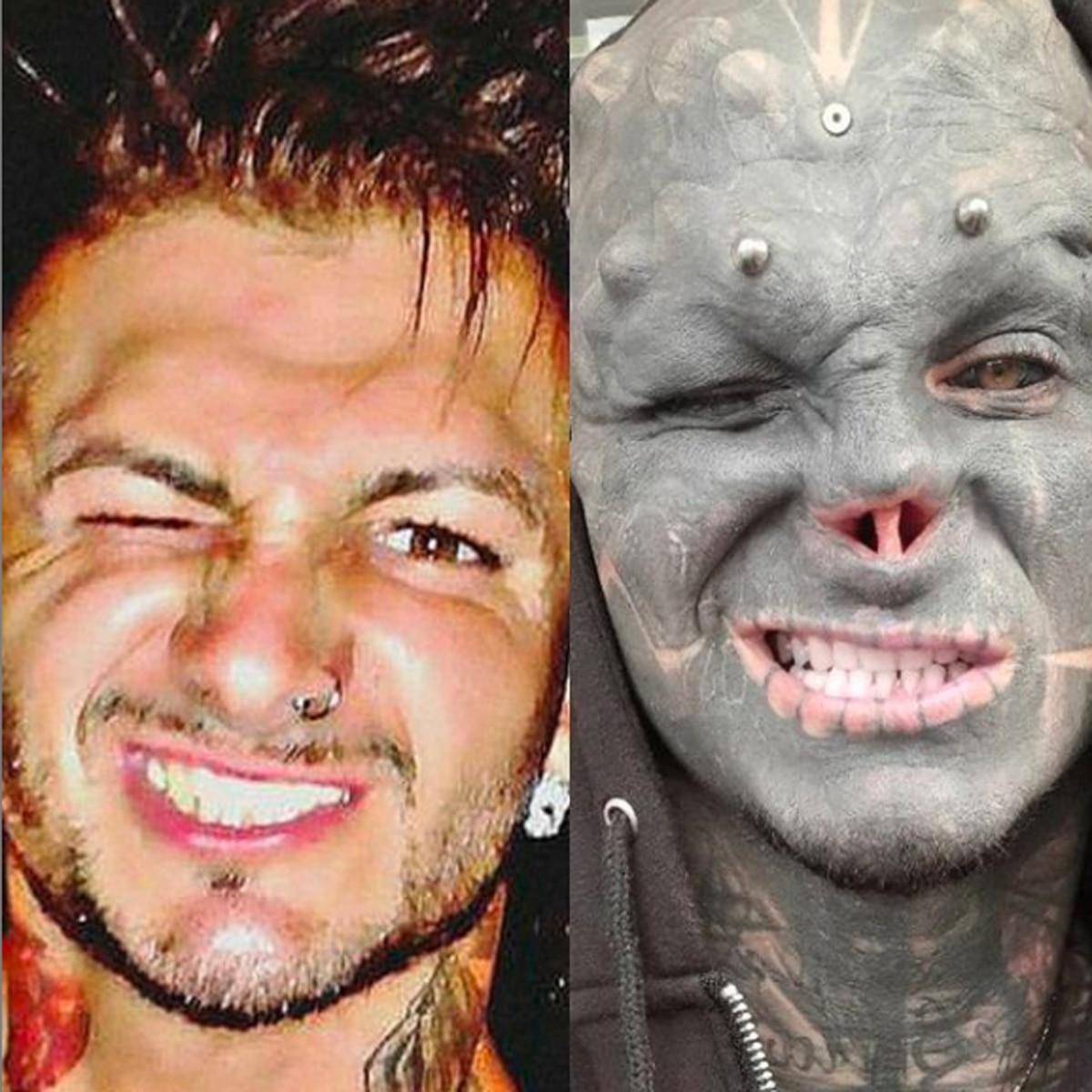 एंथनी लोफ्रेडो