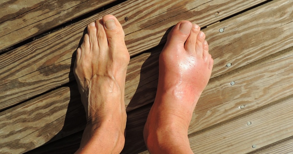 फुट कॉर्न