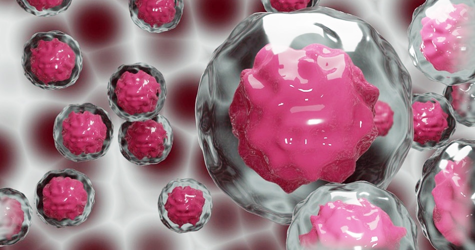 लंग कैंसर1