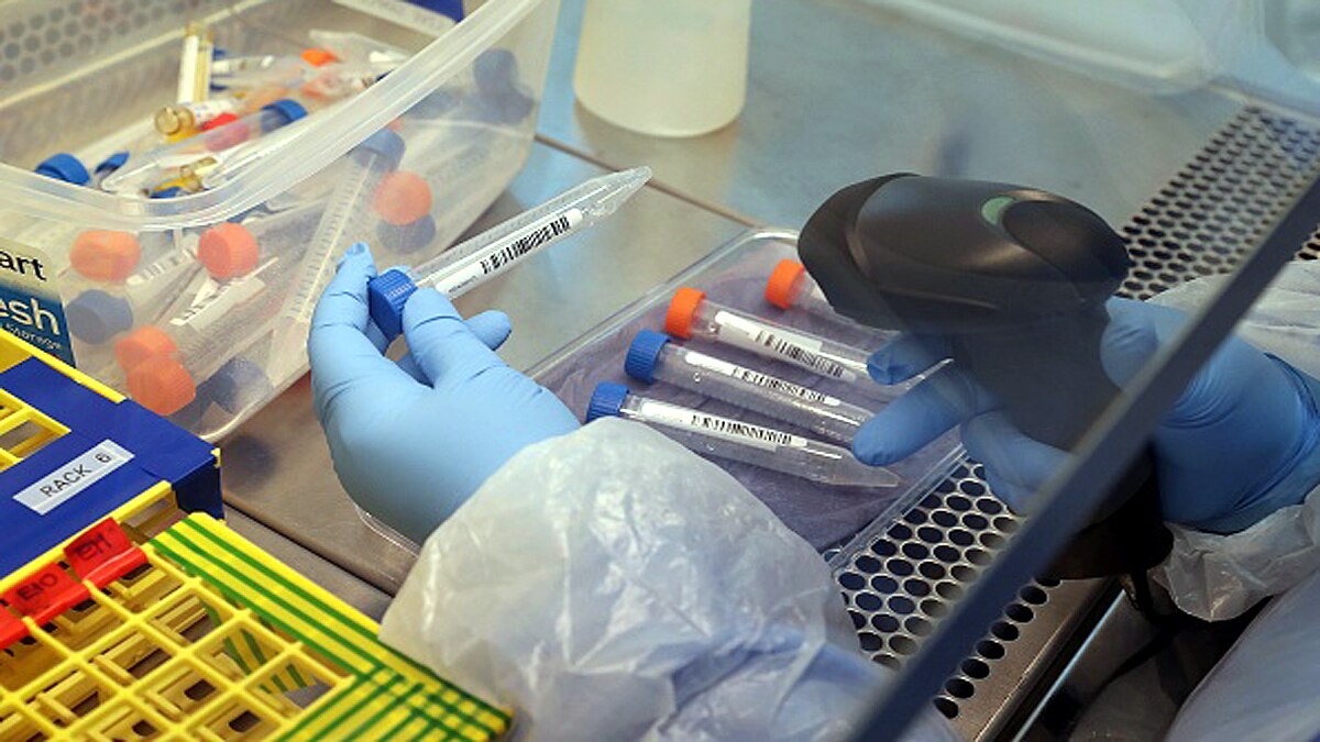 World First Coronavirus Human Challenge 