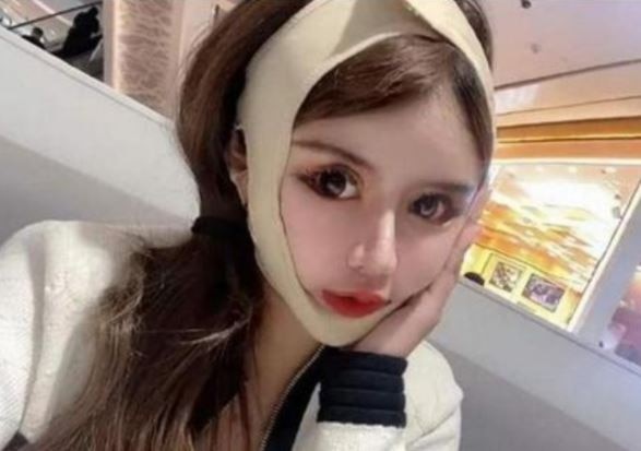 लड़की ने कराई 100 प्लास्टिक सर्जरी