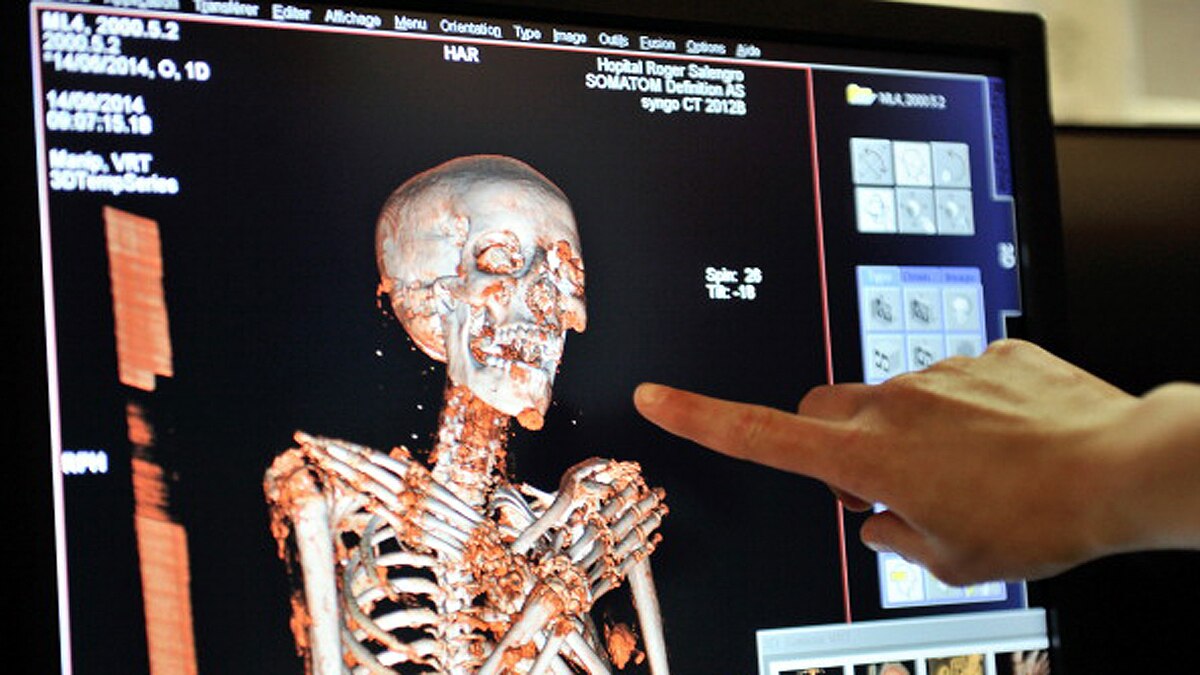 Mummy with a gold tongue