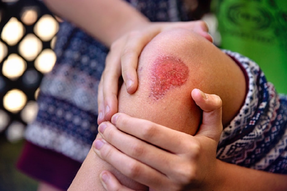 जख्म न भरना