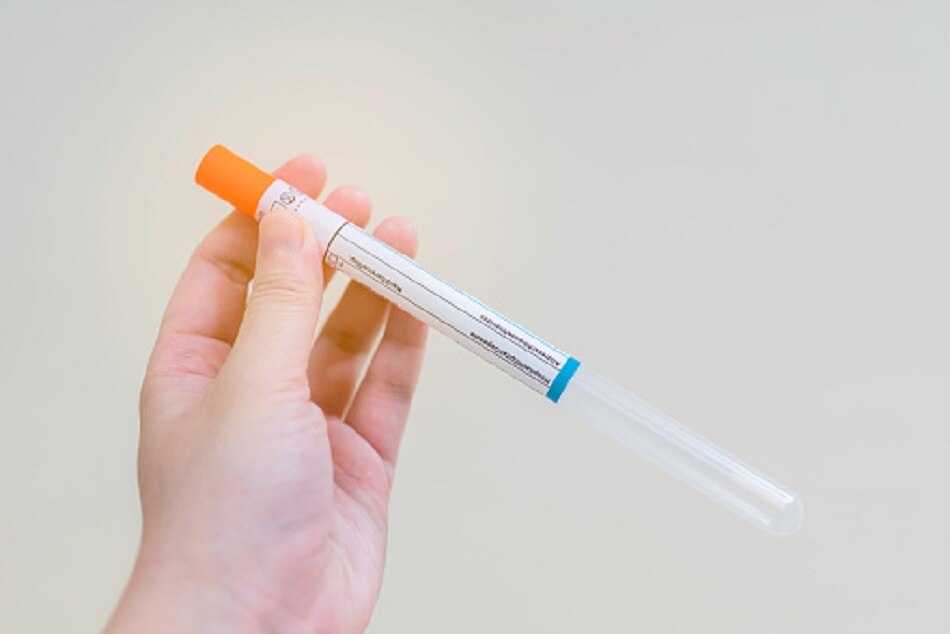 बंदरों पर किया गया ट्रायल