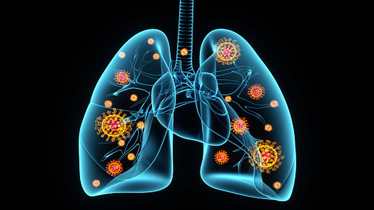 Targeting Nsp1 protein pathway Corona Therapy 