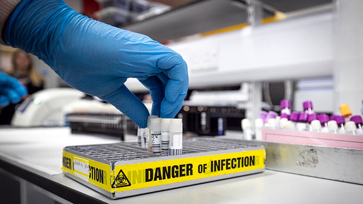 Potential antiviral treatment for Corona identified