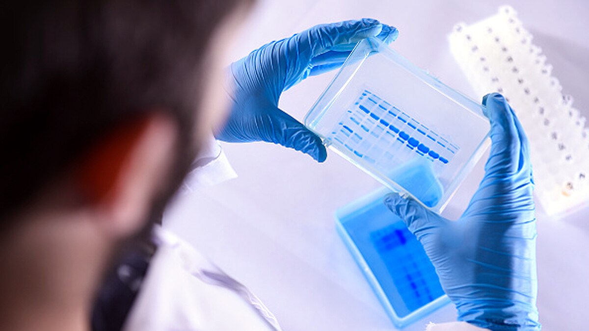 Potential antiviral treatment for Corona identified