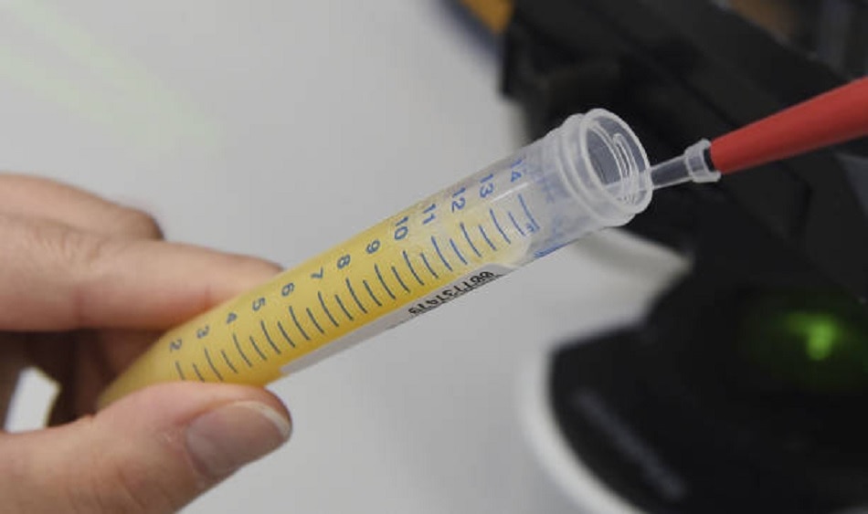 कोरोना वायरस इन्फर्टिलिटी 1