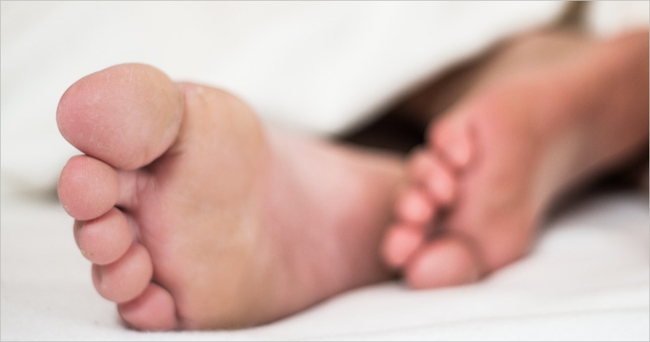 फटी एड़ियां 2