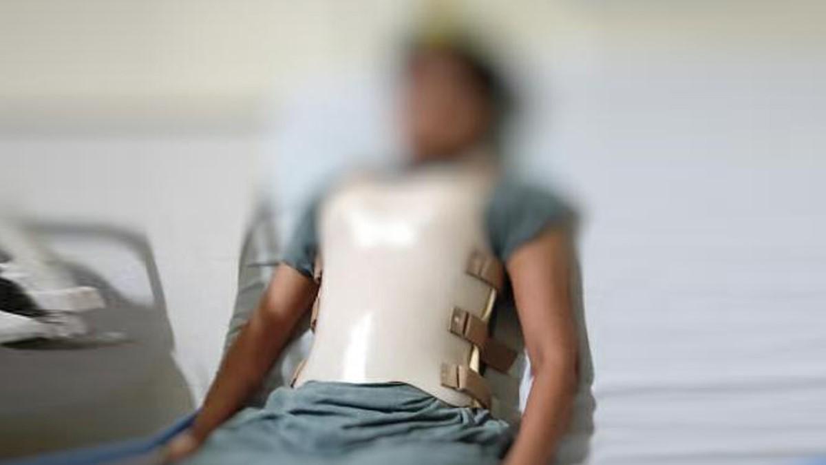 बदमाश ने लड़की पत्थर से पीटा (फोटो- रवीश पाल सिंह)