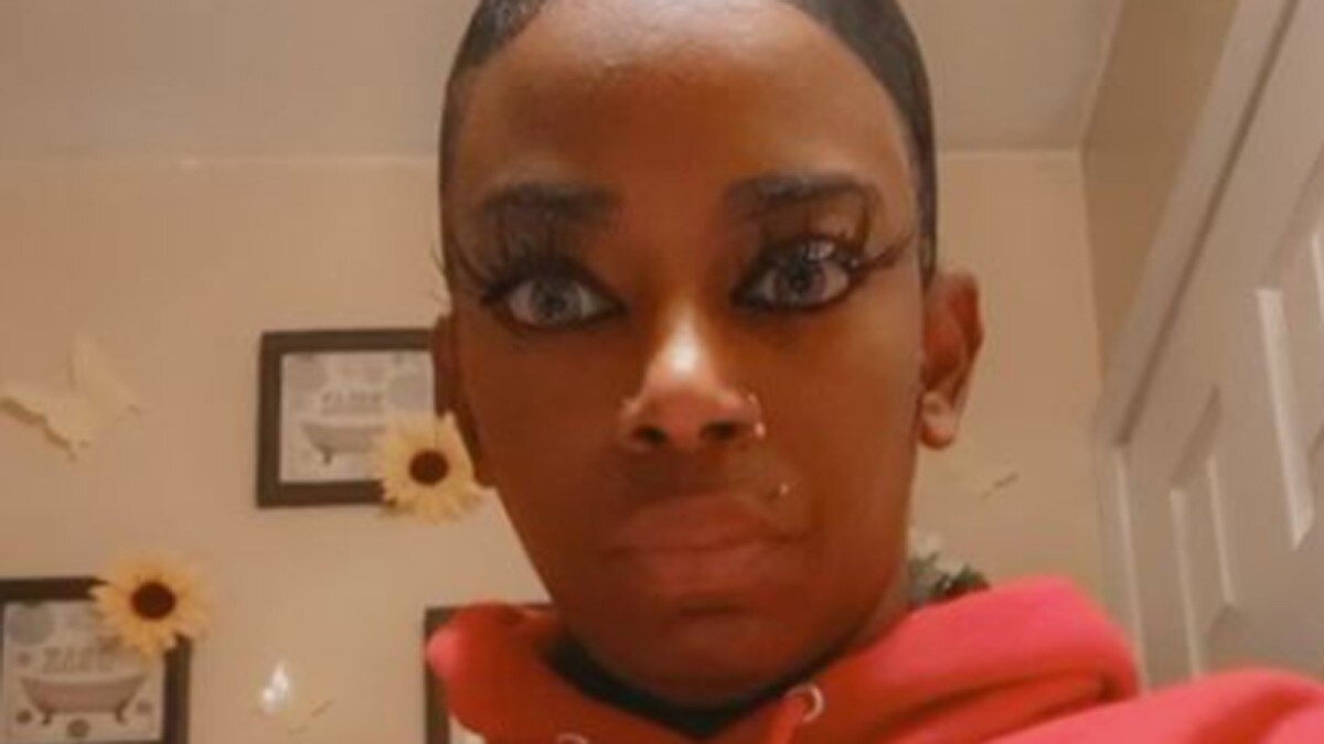 हेयर स्प्रे लगाना पड़ गया भारी