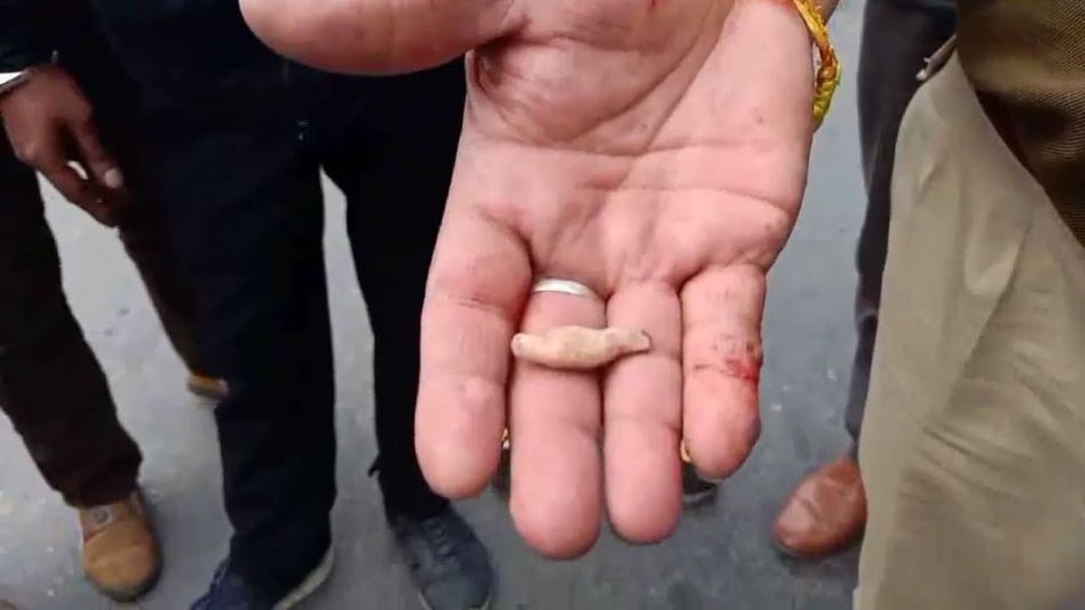 चोर ने पुलिसकर्मी का कान चबा डाला (फोटो- सुनील लाखा)