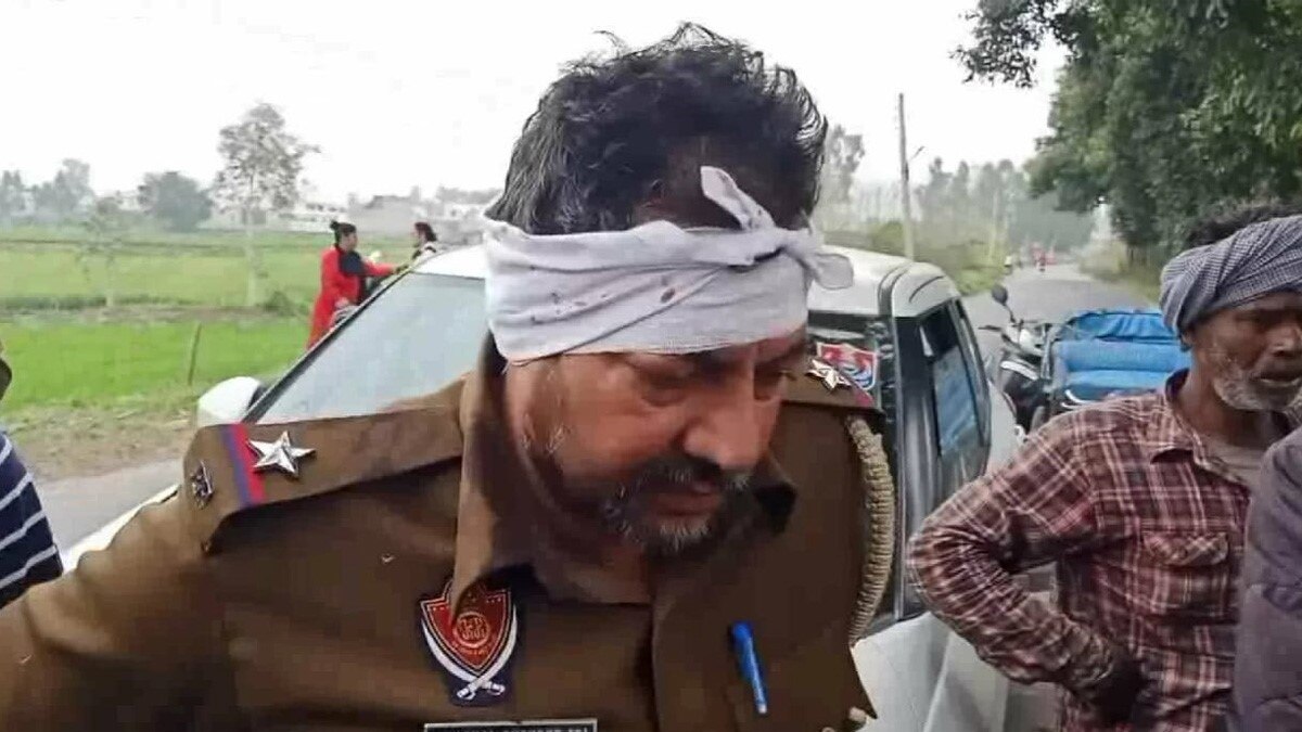 चोर ने पुलिसकर्मी का कान चबा डाला (फोटो- सुनील लाखा)