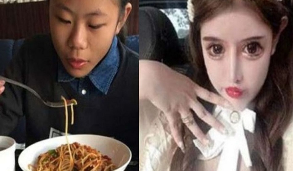 लड़की ने कराई 100 प्लास्टिक सर्जरी