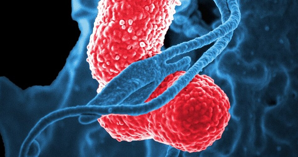 नॉन स्मोकर्स में लंग कैंसर के कारण