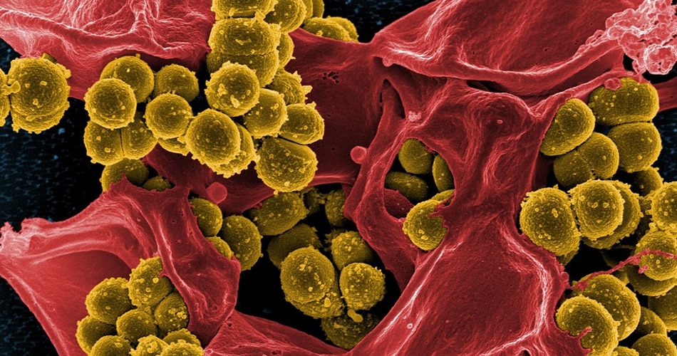 बैक्टीरिया को मारता है