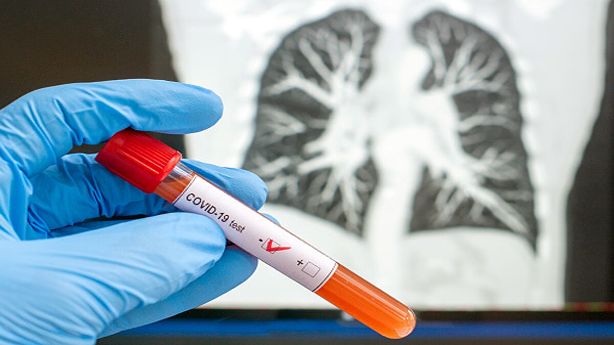 Coronavirus can dodge vaccination 