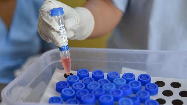 सरे-चौथे दिन 24 फरवरी को रात को हल्की सी ठंड लगी, बुखार आया.