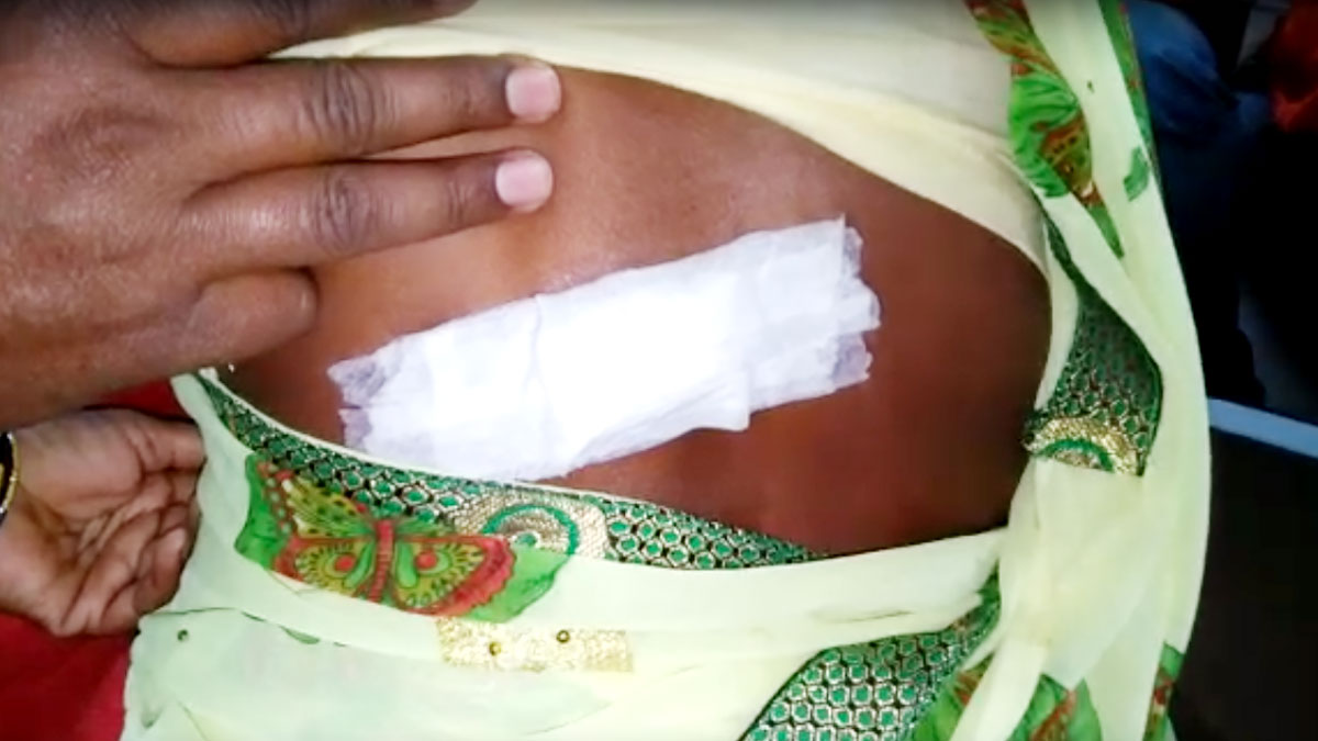 महिला की पीठ में फंसी थी गोली (फोटो-उमेश मिश्रा)