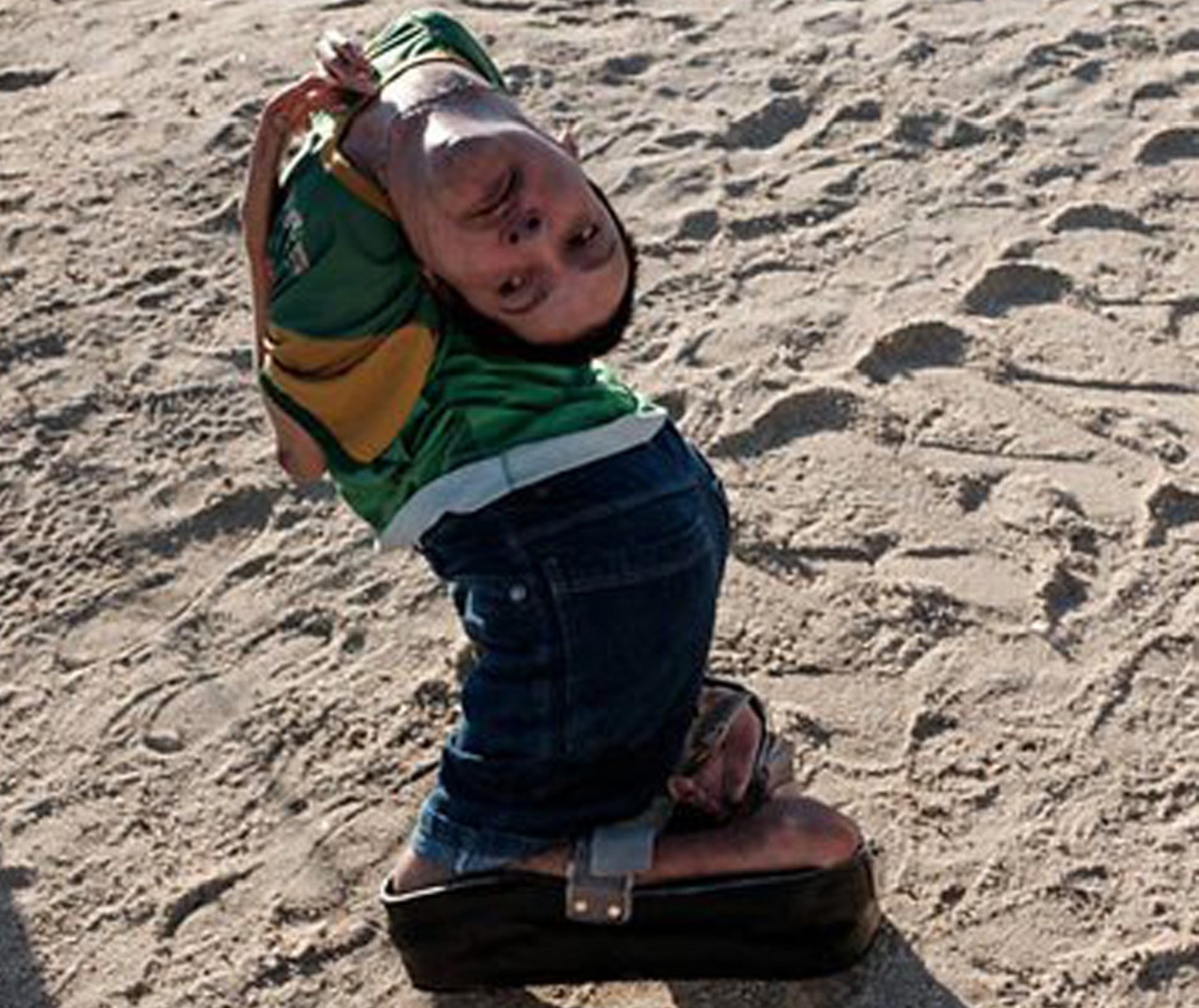 उल्टे सिर के साथ पैदा हुआ था शख्स