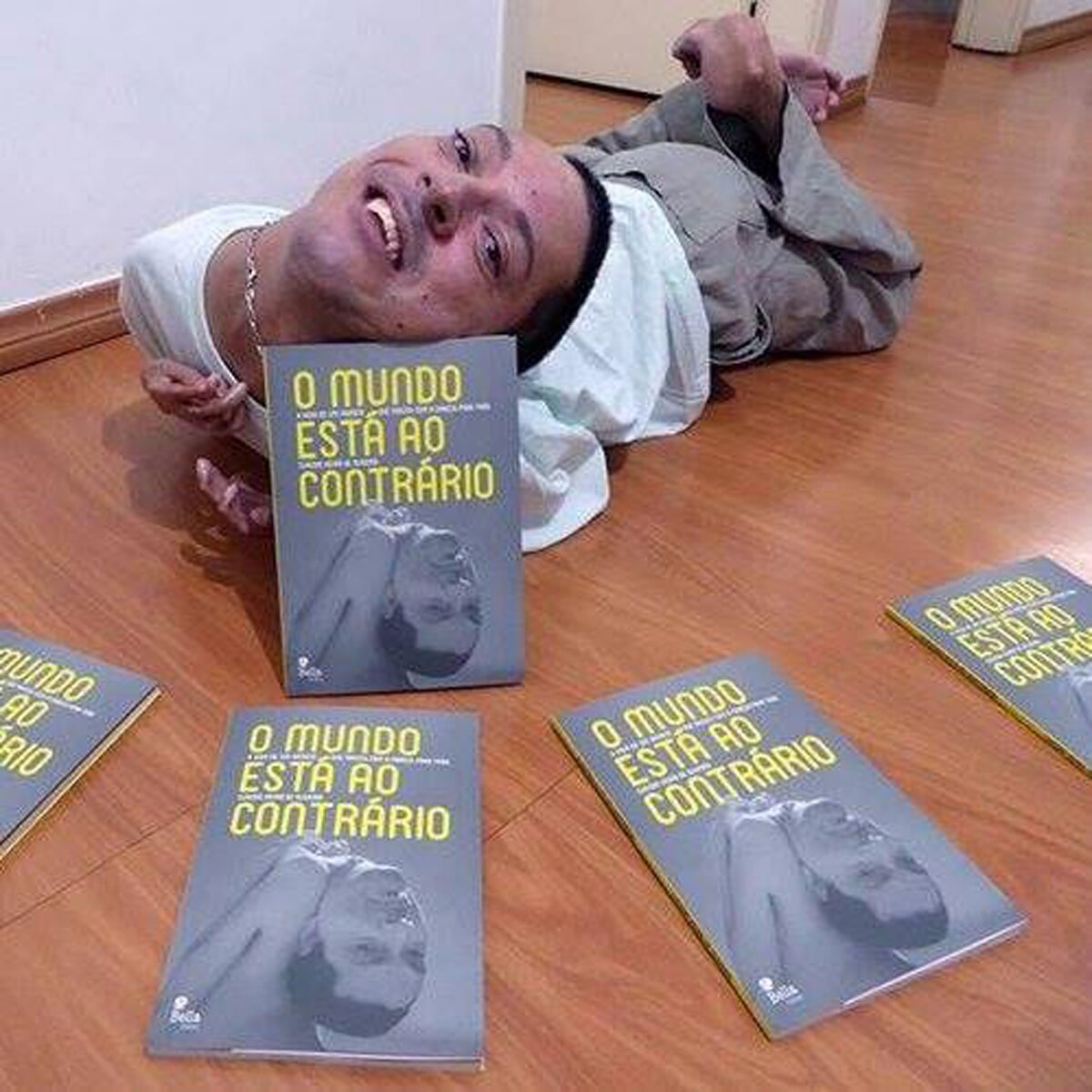 उल्टे सिर के साथ पैदा हुआ था शख्स